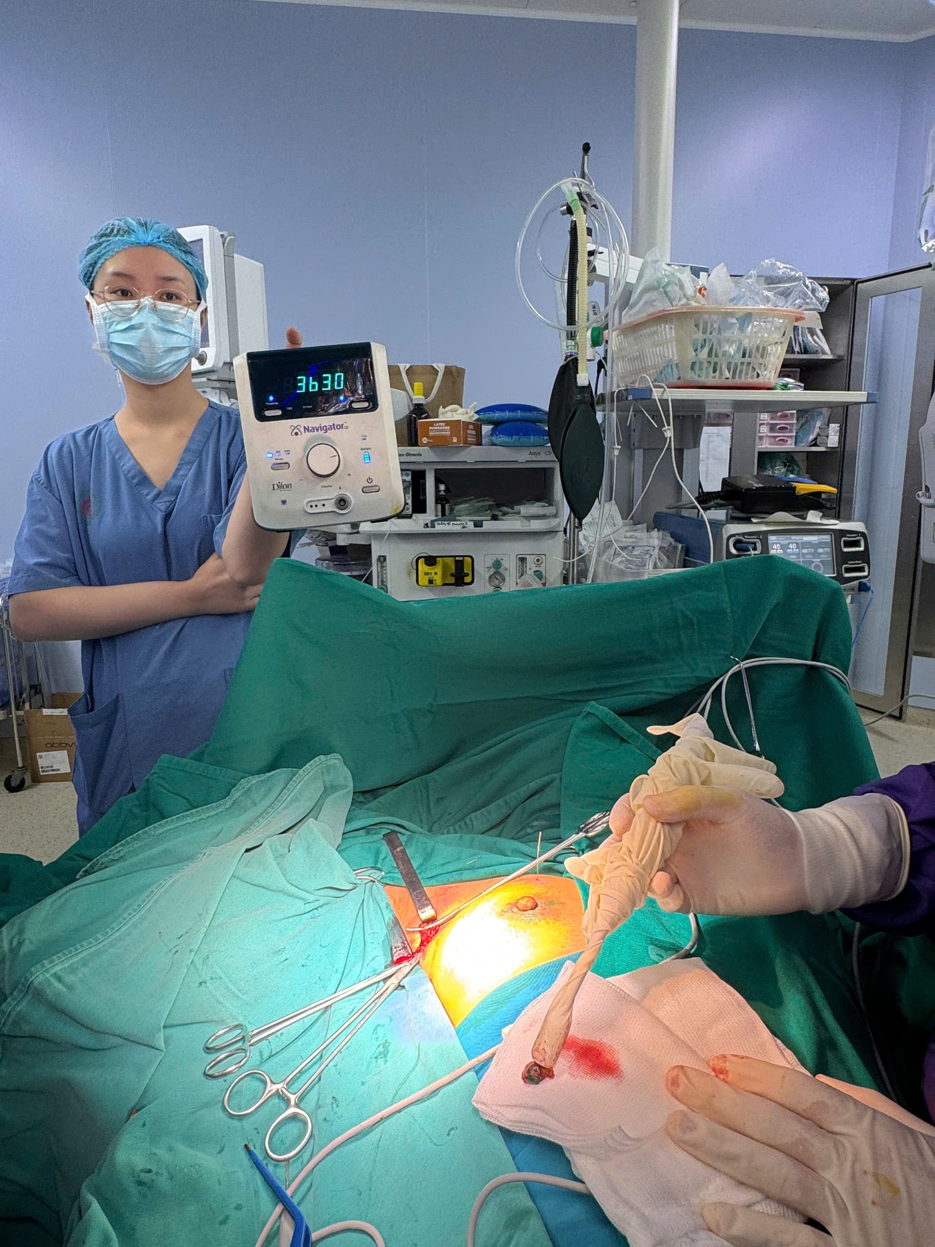 Sinh thiết hạch gác bằng đồng vị phóng xạ (Gamma Probe) kết hợp ICG và tái tạo tức thì trong phẫu thuật ung thư vú